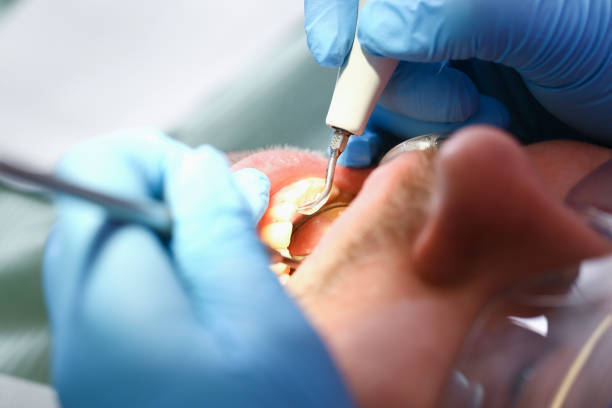 Best Emergency Root Canal Treatment in Mount Gay Shamrock, WV